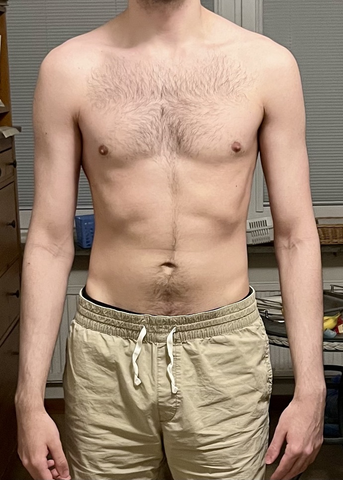 Does this body type look malnourished or overly skinny?