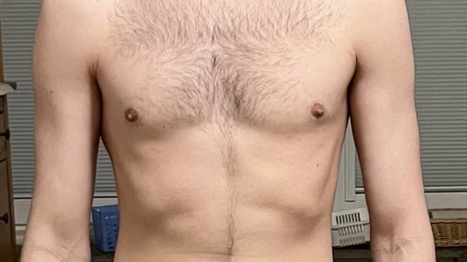 Does this body type look malnourished or overly skinny?