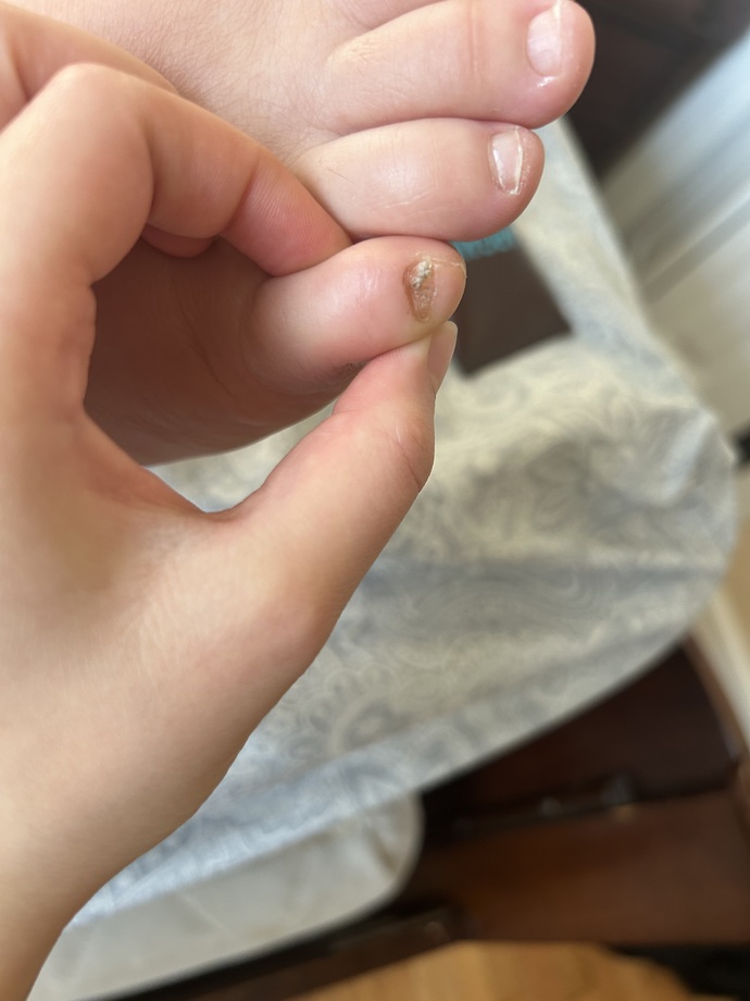 What is this on my toes?