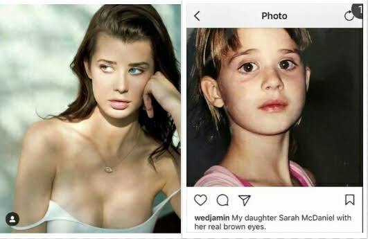 Did you know thereās surgery to change eye colour?