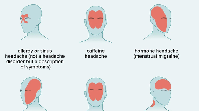 Should humans let nausea and headaches go away naturally?