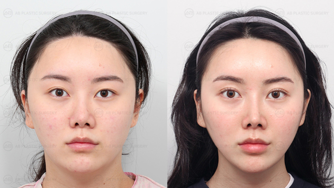Why are people shamed for altering their appearances?