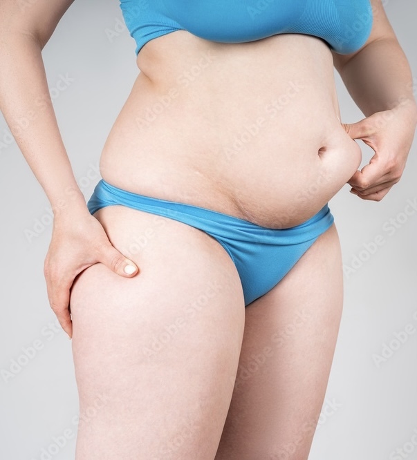 Ladies would you rather have a flat belly, toned, flabby or a large belly?