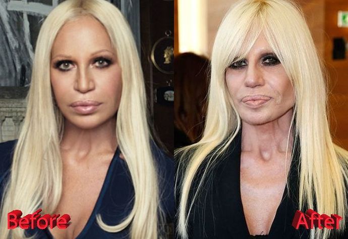 2- Donatella Versace