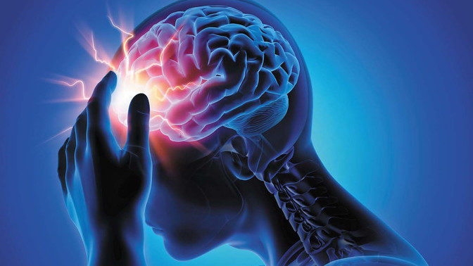 How do you normally handle a headache?
