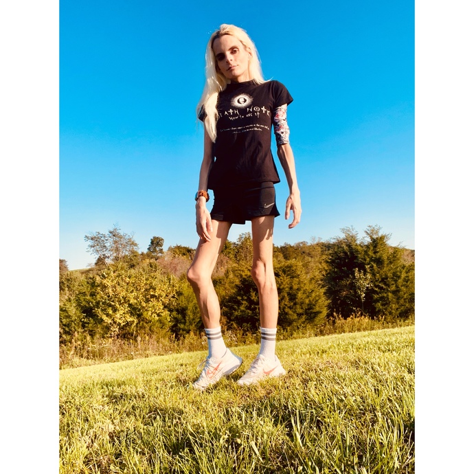 Do I look like I have edema?