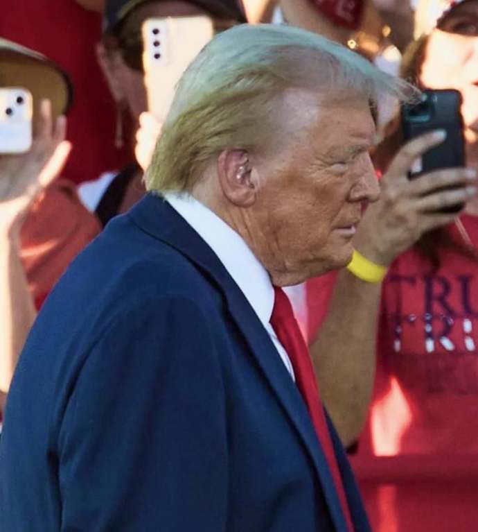 So whats the deal with Trumps skin?