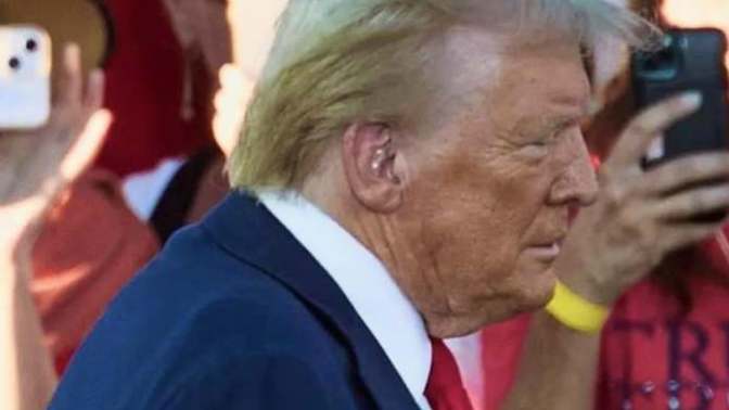 So whats the deal with Trump's skin?