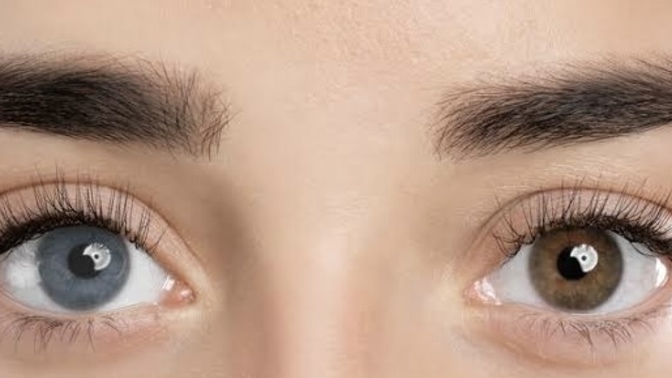 Do you think you would consider dating a person with Heterochromia?