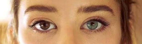 Do you find Heterochromia attractive?