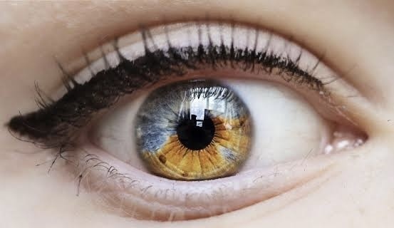Do you find Heterochromia attractive?
