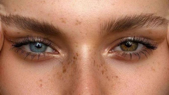 Do you find Heterochromia attractive?