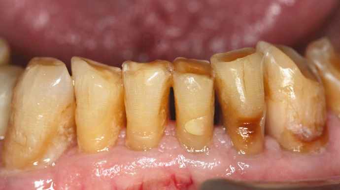 Is not having perfect teeth a turnoff?