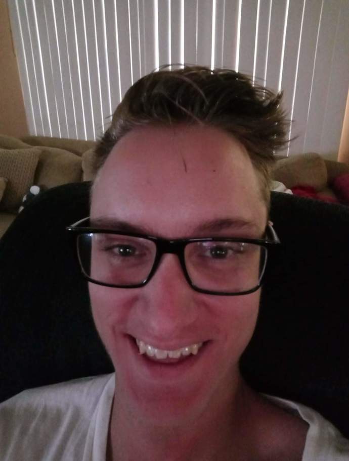 Girls, Not very confident in general especially my smile/laugh due to flat affect/anxiety. Does my smile look fine?
