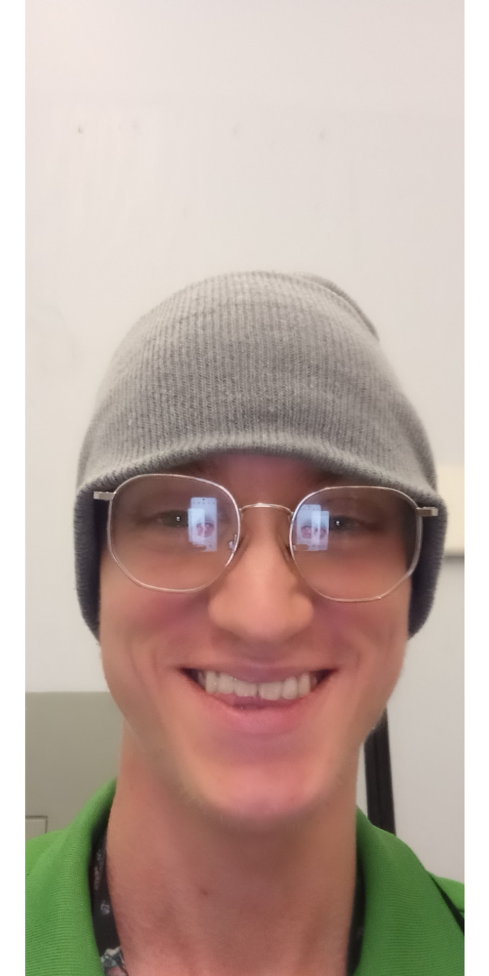 Girls, Not very confident in general especially my smile/laugh due to flat affect/anxiety. Does my smile look fine?
