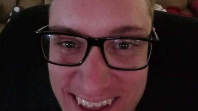 Girls, Not very confident in general especially my smile/laugh due to flat affect/anxiety. Does my smile look fine?