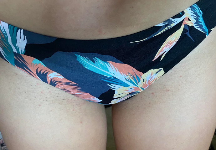 Me in swim brief with bumps