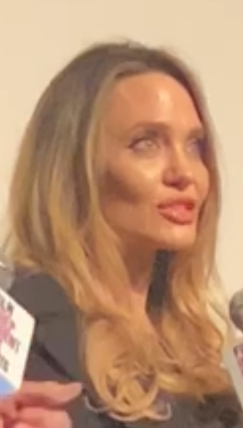 nose job, hip job, cheek job