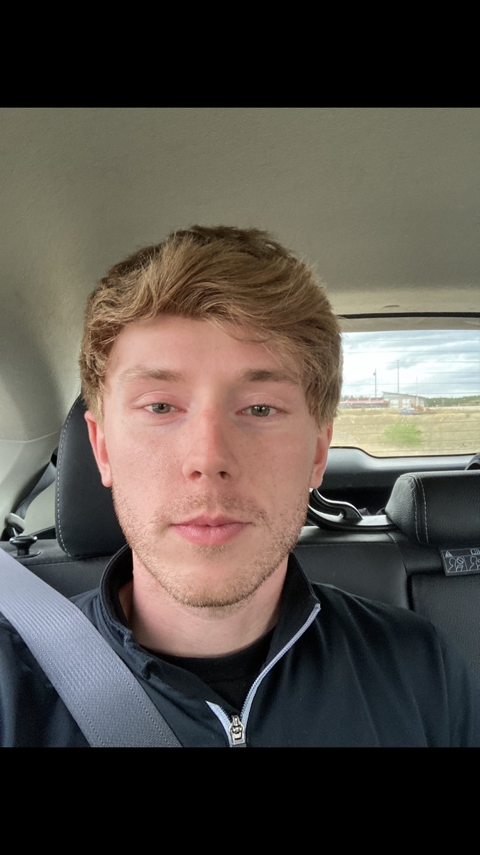 As a guy who wears a wig due to alopecia-when should I share with a date? I’m comfortable right away but feel it’s a 2/3 date in talk?