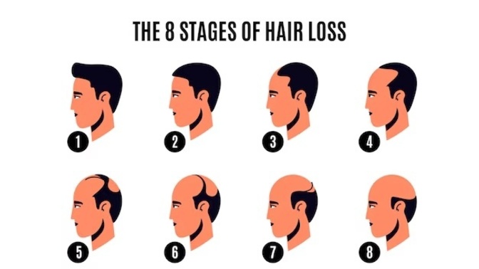 Do you prefer a guy with short or long hair? Or even bald?