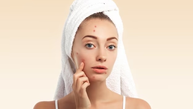 What helps against acne?