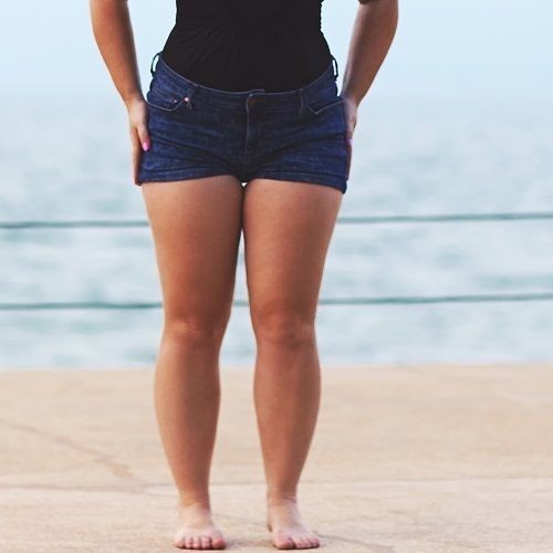 Do men okay with unperfect legs, big thighs with scar?