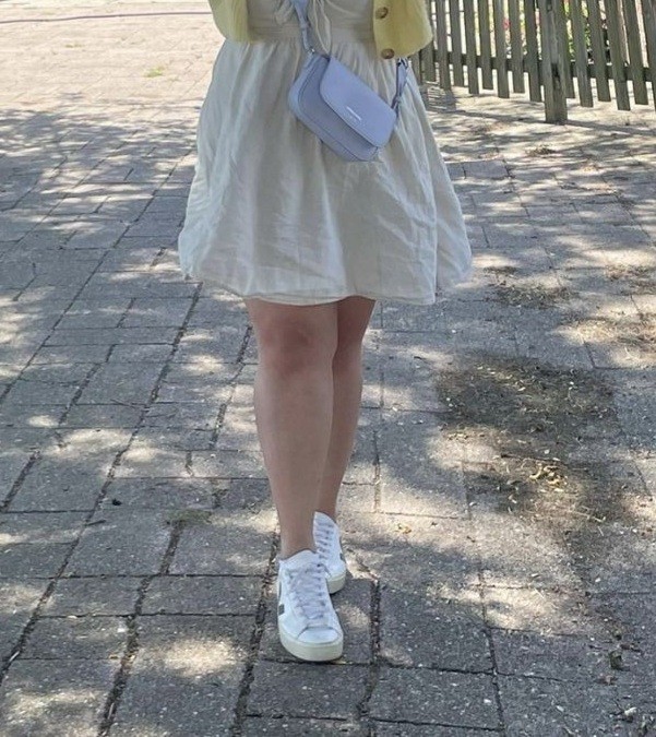 Do men okay with unperfect legs, big thighs with scar?