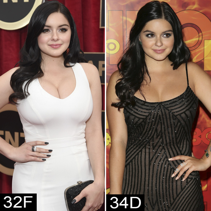 What age is acceptable for a breast reduction? Is it age or size? Or even actual/predicted medical problems? Vanity / socializing reasons?