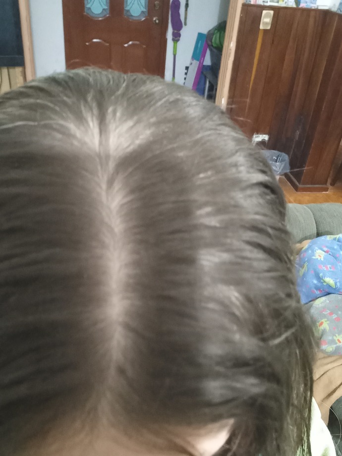 Is there silver or gray hair?