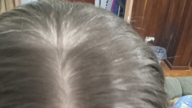 Is there silver or gray hair?