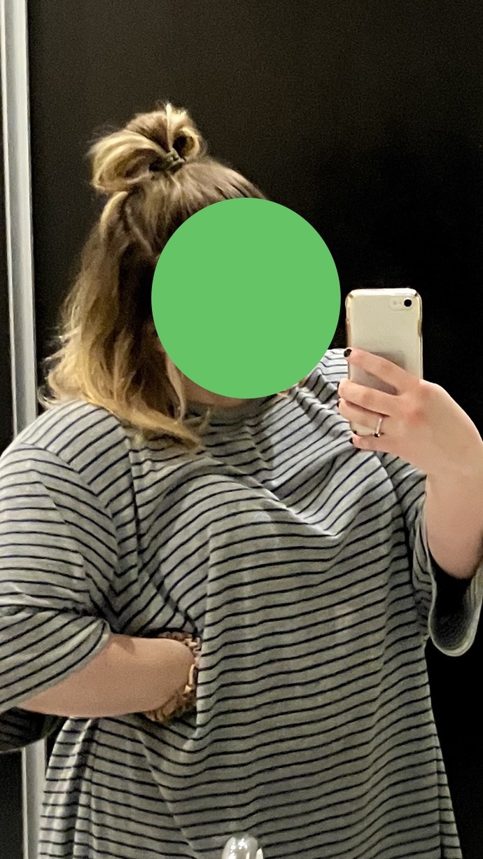 Trying to grow my hair down to my waist but I bleached it a year ago and it appears to be pretty damaged, should I chop it off?