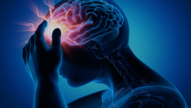 Has anyone here ever had a concussion?