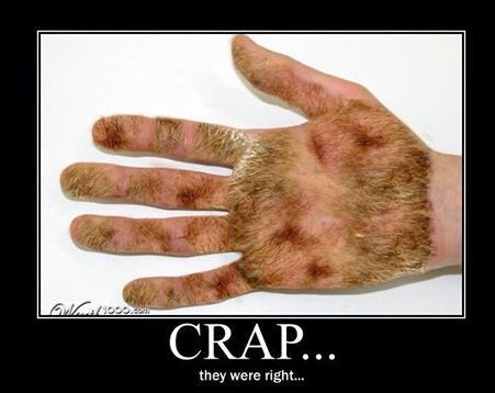 Whats happening to my hands?