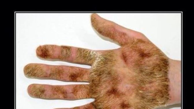 What's happening to my hands?