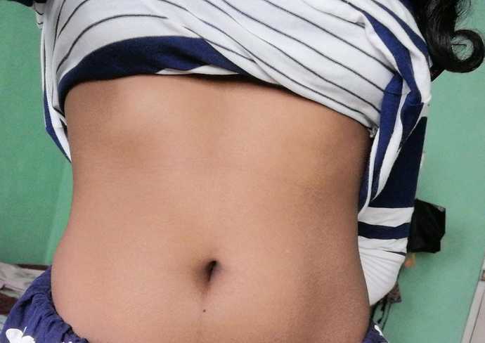 Should I get a Navel Piercing?