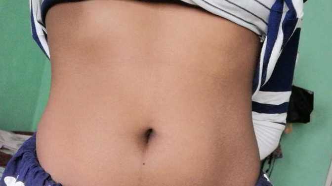 Should I get a Navel Piercing?