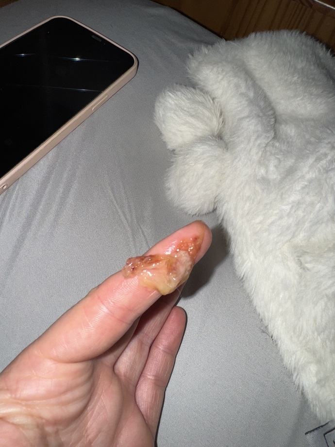 Is this bacterial or viral sinusitis?