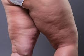 Girls, which thighs are you closer to and which do you prefer?