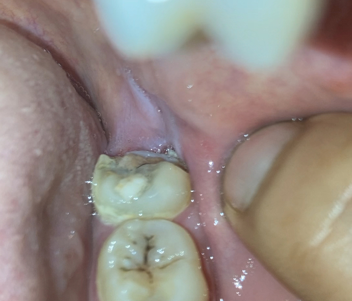 Should I pass on a dentist?