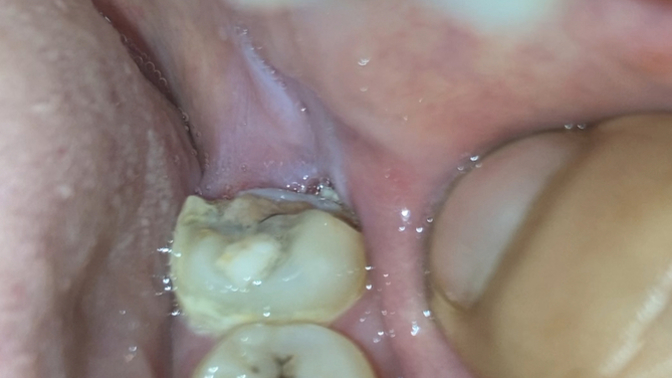 Should I pass on a dentist?
