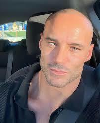 Does anyone else find bald men icky?