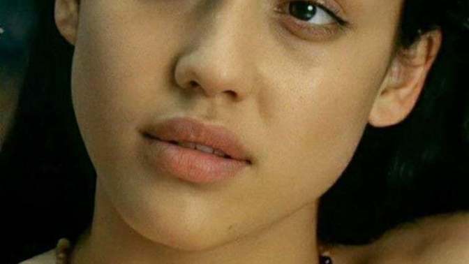 Do you find this type of nose ugly?