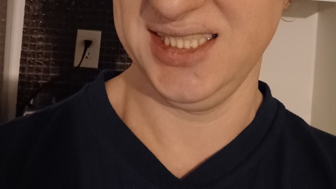 Do you have nice teeth or at least white?