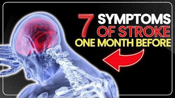 Since one of our members IronMan, recently had a stroke, I am posting these early signs of a stroke. Will you watch it & not end up like IronMan?