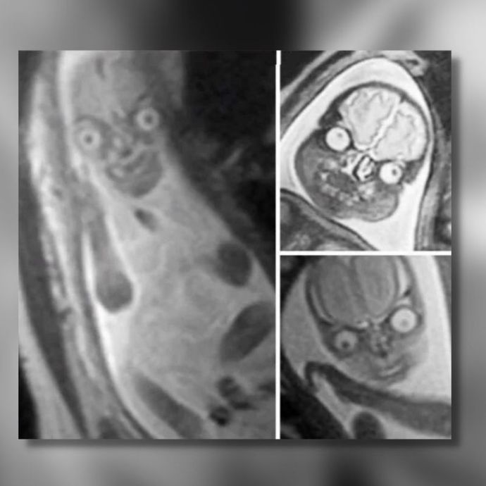 How would you feel if the doctors took an mri scan, and said this is your baby?
