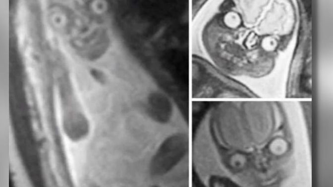 How would you feel if the doctors took an mri scan, and said this is your baby?