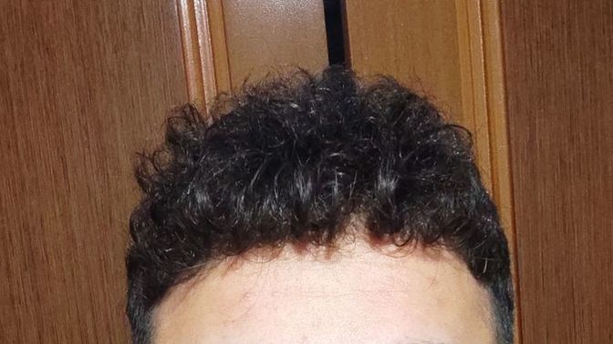 Do you think I should do keratin treatment on my hair?