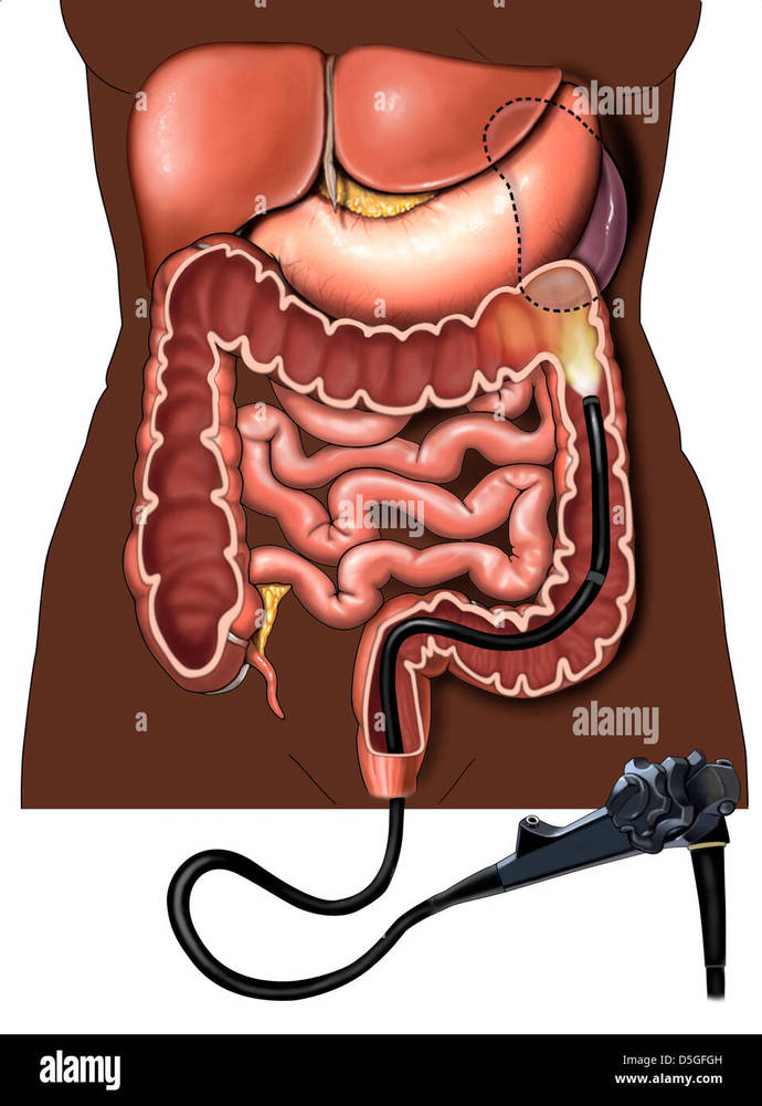 Whats the worst medical examination youve ever had?