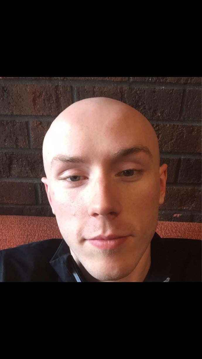 Girls 18-28, could you date a bald guy your age? can he still be attractive with no hair? or is it a turn off?