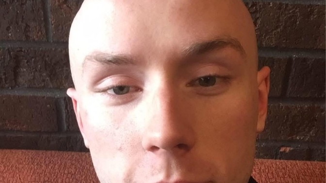 Girls 18-28, could you date a bald guy your age? can he still be attractive with no hair? or is it a turn off?